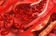 Bad cholesterol in blood. 3d illustration..