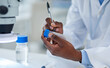 © peopleimages.com - Experiment, hand and sample in lab, scientist and medical of study, innovation and future for health. Person, label and science of discovery, closeup and career as pharmaceutical and research