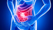 The Grasp of Discomfort: A 3D Illustrative Insight into Gut Pain and Intestinal Distress.