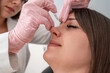 Nose contouring and beauty enhancement with Botox injection: cosmetic dermatology procedure