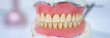 Dental prostheses, dental concept. stock photo