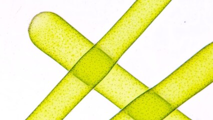 The water net (Hydrodictyon sp) under microscope. Collected from paddy fields in Indonesia. 