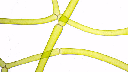 The water net (Hydrodictyon sp) under microscope. Collected from paddy fields in Indonesia. 