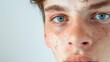 © Andrey - Closeup portrait of a blue-eyed young man with freckles on his face.