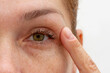 © Tatiana Foxy - Close up cropped eye of middle aged caucasian woman looking at camera holding finger on eyelid
