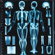 X-ray images from patient, ai-generatet