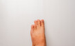 close up of a foot of a man with brachymetatarsia or Morton's foot, a condition in which there is abnormal shortening of one or more metatarsals on a white background, 