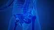 © Cinefootage Visuals - Skeleton with osteoarthritis hip joint injury