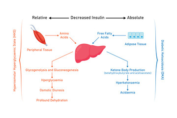 Wall Mural - Hyperosmolar Hyperglycemic State (HHS) and Diabetic Ketoacidosis (DKA) Scientific Design. Vector Illustration.