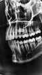 a dental xray shows the teeth of someones mouth