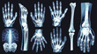 Realistic x-ray shots collection. Human body hand l