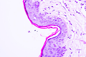 backgrounds of human cells tissue of cervix under the microscope in pathology lab.view in microscopi