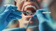 Close-up view of a dental check-up in progress with a patient's open mouth and dentist's hands with tools performing an oral examination..