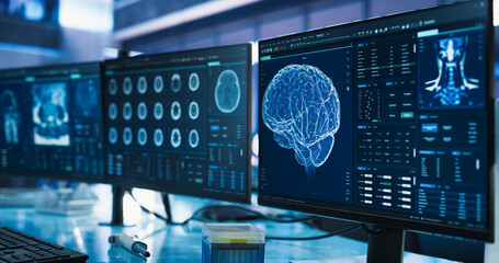 Poster - Cancer Research Center Medical Laboratory: Close Up of a Set of Desktop Computer Monitors Showing CT Scans Of Human Brain. Specialist Studying Brain Tumor, Finding Solutions, Treatment