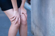 Asian woman having knee osteoarthritis joint pain or knee injury problem, concept of injured leg, knee joint surgery, orthopedics treatment