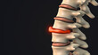 © jitendra jadhav - Bulging disc in the human spine