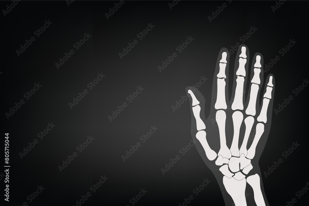 X Ray Rabbit Hand Anatomy and body part: X-ray hand of human Stock Vector | Adobe Stock