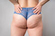 Woman with fat hips and buttocks, overweight thigh, obesity female body with cellulite