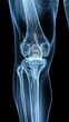 © Thanate - Professional X-Ray Image Reveals Knee Joint Structure, Ideal for Healthcare Diagnostics