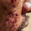 Visual Representation of Symptomatic Effects Following a Tsetse Fly Bite on Human Skin