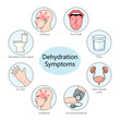 common symptoms of dehydration including dizziness, dry mouth, and thirst diagram hand drawn schematic raster illustration. Medical science educational illustration