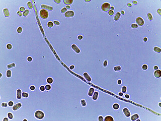 photo of fungi spores and mycelium under the microscope