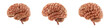 © DETHAL - Set of human brain isolated on transparent and white background
