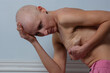 Contemplative bald woman in distress struggle with cancer pain