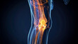 © Poramet - Sciatic nerve compression shown by leg shooting pain in photo. Concept Sciatica