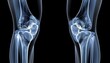 © NanzXy - X-ray of human knee joint views of the femur, patella, and tibia Concept of orthopedic health, joint diagnostics, and advanced medical education