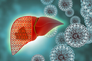 Wall Mural - Diseased liver, damaged cells on abstract medical background, liver cancer. 3d illustration