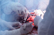 Abdominal plastic operation in hospital. Closeup surgeon in sterile gloves make tummy tuck surgery