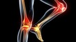 Radiographs x-ray of the lower leg and foot are shown in red and yellow on a black background 3D rendering. Knees and joints hurt, medical help from a doctor, consultation with an orthopedic