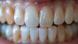 © Kateryna Kordubailo - Woman's teeth in need of whitening may indicate dental discoloration or staining, potentially affecting confidence and self-esteem