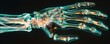 © Amemage - An X-ray of a hand with bones and nerves highlighted