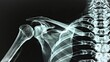 A creative and clear Xray representation of the shoulder and spine, designed specifically for a chiropractic pain consultation ad, emphasizing the scapula and vertebrae alignment