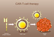 CAR-T cell therapy. cancer immunotherapy. Chimeric antigen receptor