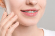 © New Africa - Smiling woman with dental braces on grey background, closeup