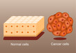 cancer cells and normal cell