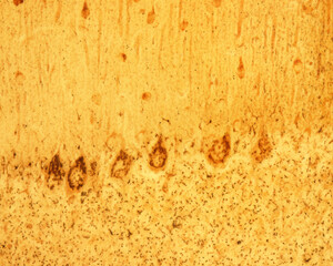 Poster - Cerebellum. Purkinje neurons. Golgi apparatus