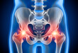 Medical x ray 3D illustration of a painful hip joint