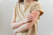 © Pormezz - young woman scratching on her arm and has a red rash irritation on her skin from dust intolerance.