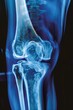 © Media Srock - Advanced medical technology Knee X-ray offers insights for precise diagnosis and care