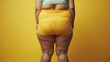 © Mehran - Image of a overweight woman with visible cellulite on her thighs and buttocks.