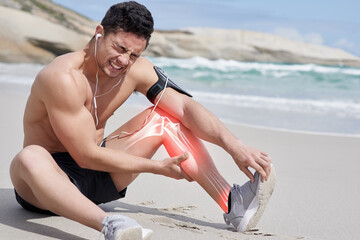 Canvas Print - Athlete, runner and man at beach with calf pain or sports injury in workout, training or fitness exercise in Miami. Earphones, red glow and male person with accident and emergency with leg or muscle