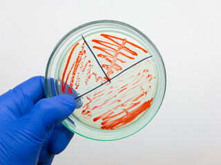 Poster - Yeast colonies grown on a Petri dish in the laboratory.