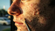 © Kanchanit - Persistent Acne Issues: Close-Up View of Skin Afflictions, Dermatological Treatment