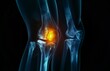 © Stocks Buddy - A detailed X ray of the knee with a glowing yellow pain spot