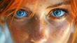 © Akash Tholiya - Close-Up Of A Young Woman's Face, Highlighting Her Freckled Skin And Striking Blue Eyes
