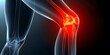 © Anastasiia - Red glowing knee joint with rheumatoid arthritis pain in human body. Concept Rheumatoid Arthritis, Knee Joint, Pain Management, Human Anatomy, Medical Conditions